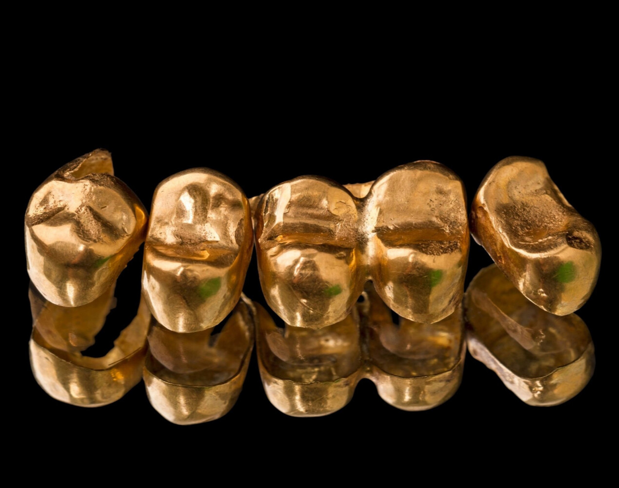 Скупка  стоматологического золота в Костроме